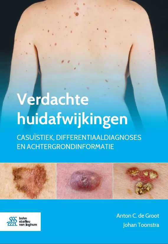 Verdachte huidafwijkingen