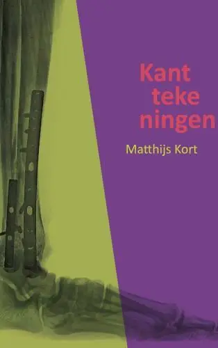 Kanttekeningen